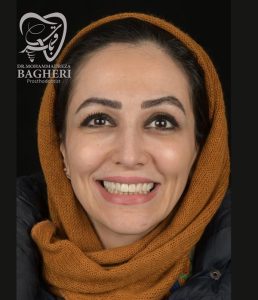 اصلاح-طرح-لبخند-2