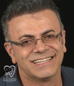 اصلاح-طرح-لبخند9