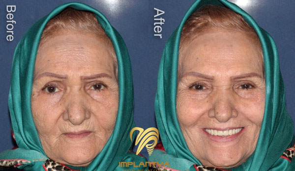 اوردنچر