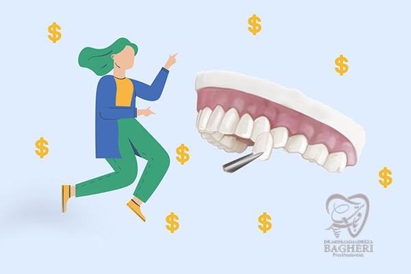 هزینه لمینت دندان در ولنجک - دکتر باقری