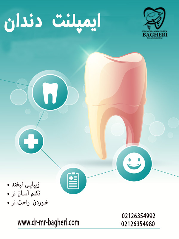 ایمپلنت دندان در ولنجک - دکتر باقری