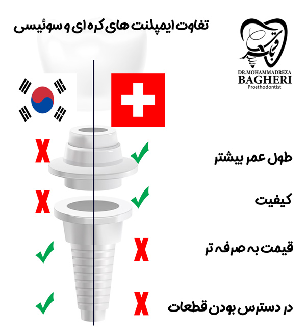 تفاوت ایمپلنت های کره ای و سوئیسی