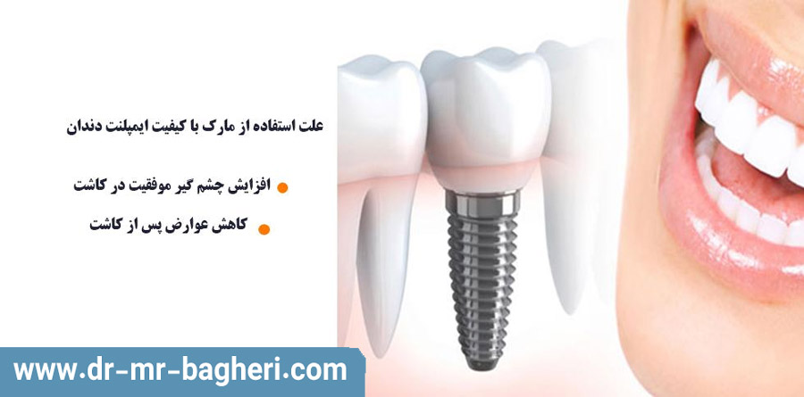 علت استفاده بهترین متخصص ایمپلنت دندان از بهترین برند ها