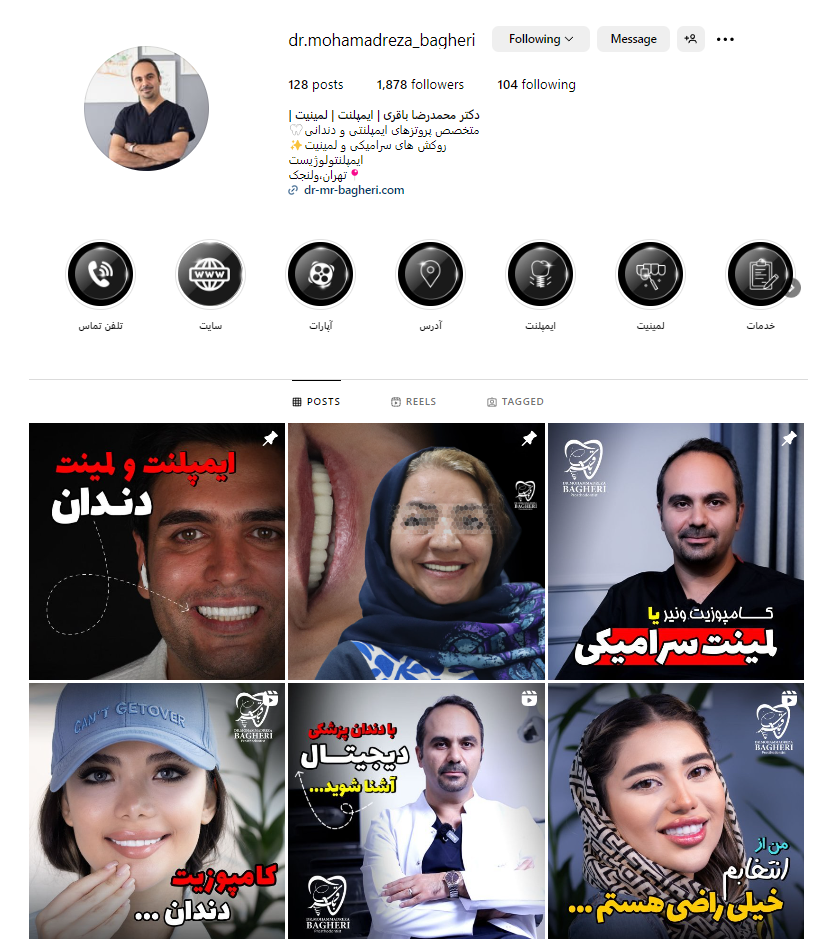 اینستاگرام دکتر محمدرضا باقری - بهترین متخصص ایمپلنت دندان در تهران